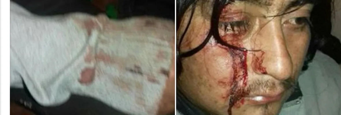 Carabineros atropella a comunero mapuche del Lov Mallekoche en Collipulli