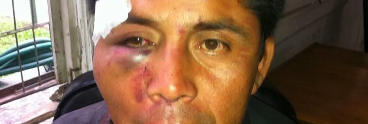 Condenan a Carabinero por salvaje golpiza contra Lonko Alberto Curamil en 2014