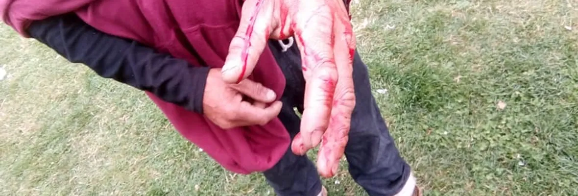 Con heridos con perdigones por Carabineros se desarrolló protesta de pescadores artesanales en Valdivia