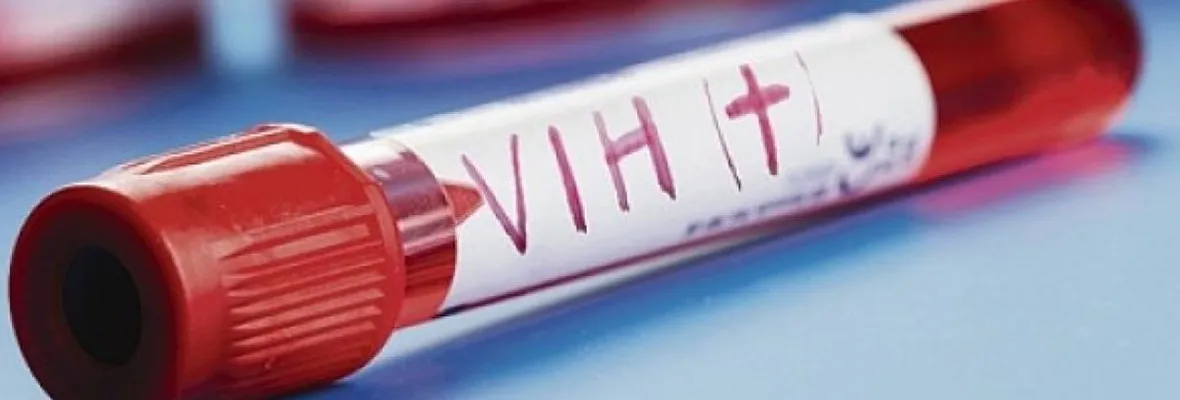 VIH: Mitos, datos, transmisión y responsabilidades públicas de esta emergencia en Chile