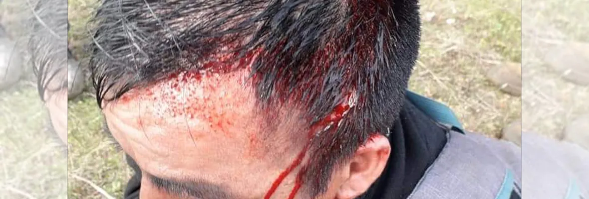 Operativo policial en Victoria deja a comunero mapuche herido de bala en la cabeza