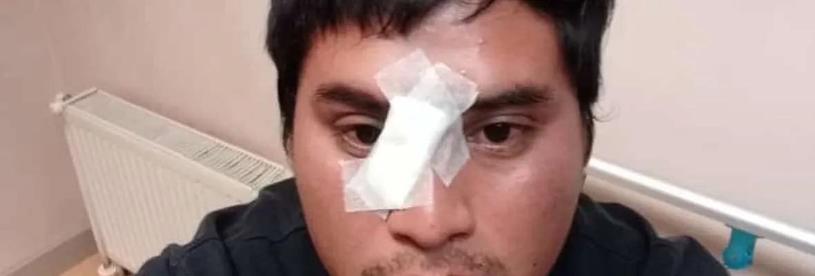 Carabineros dispara a comunero mapuche durante manifestaciones en Cañete