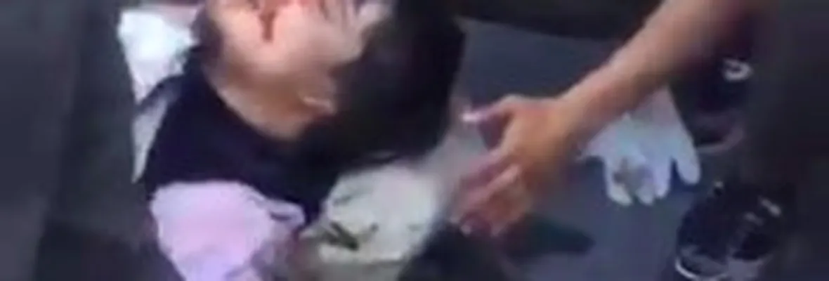 Joven pierde globo ocular por disparo de lacrimógena en Concepción