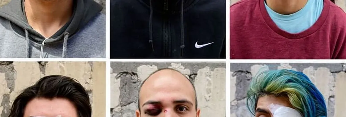 “Cría pacos y te sacarán los ojos”, la elocuente frase que refleja el daño ocular a los y las manifestantes
