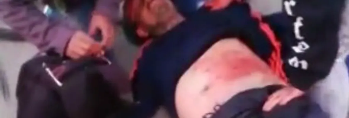 Poblador en prisión preventiva arriesga quedar con secuelas tras recibir disparo durante toque de queda en Coronel