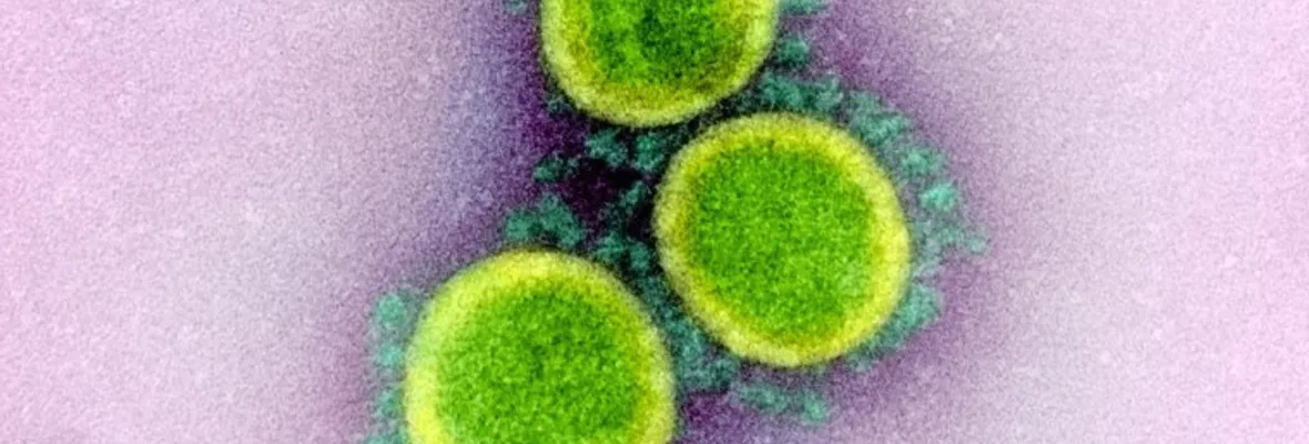 SARS-CoV-2 ha adquirido mutaciones capaces de cambiar sustancialmente su peligrosidad, indica estudio