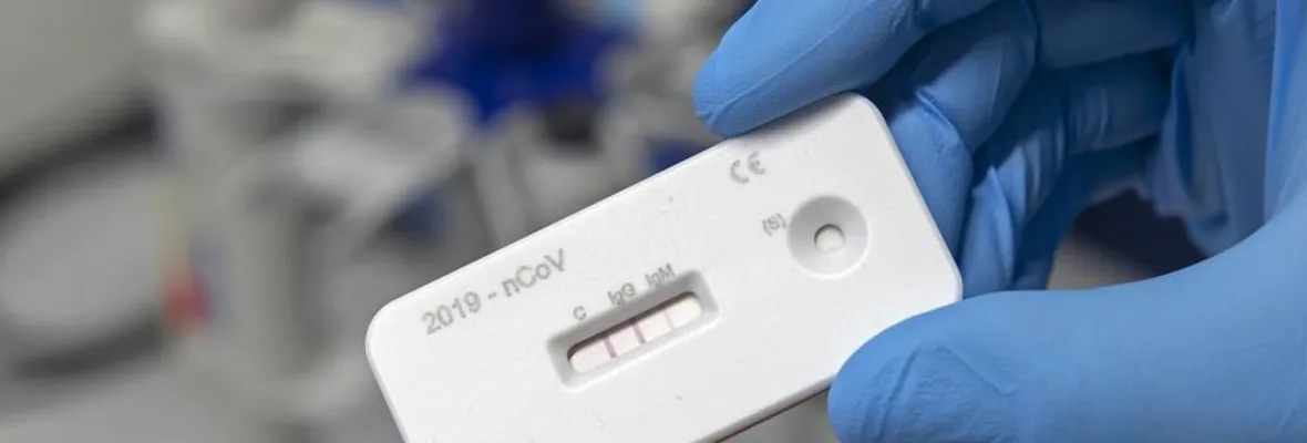 Ante falta de confiabilidad: los carnet de inmunidad pueden incluso propagar la infección COVID-19, indica la OMS