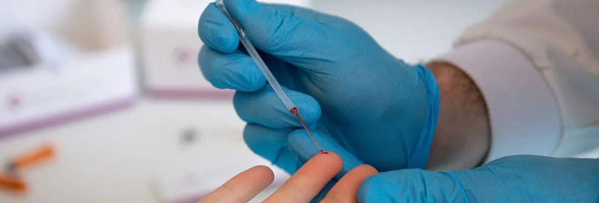 Test de anticuerpos contra coronavirus generan controversia en Estados Unidos y Europa: podrían no ser confiables
