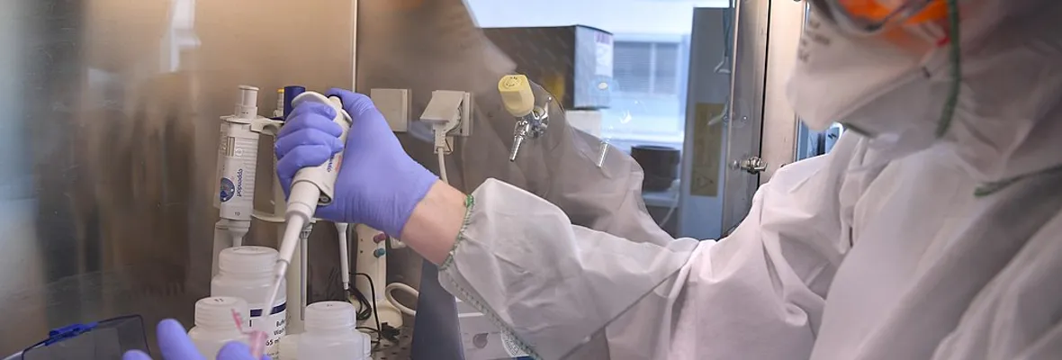 Test PCR para coronavirus podrían dar falsos negativos en primeras etapas de la infección, indica estudio