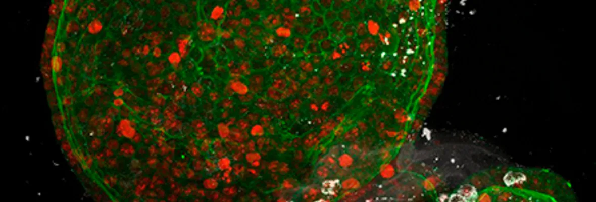 Estudios evalúan el daño a vasos sanguíneos, intestinos, riñón e hígado causados por el coronavirus SARS-CoV-2