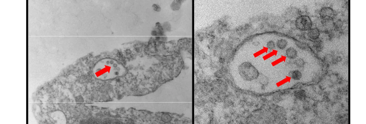 Contagios de coronavirus a más de 8 metros de distancia revela investigación en procesadora de carne de Alemania