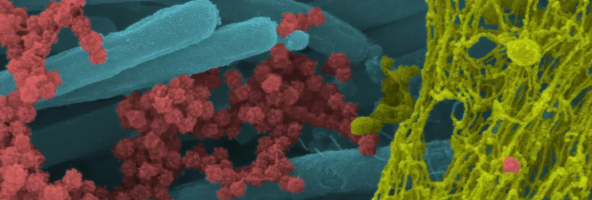 Publican soprendentes imágenes de coronavirus SARS-CoV-2 infectando células respiratorias
