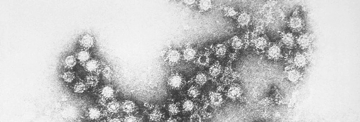 Los enterovirus que se adapten a ambientes cálidos podrían ser más difíciles de eliminar, indica estudio