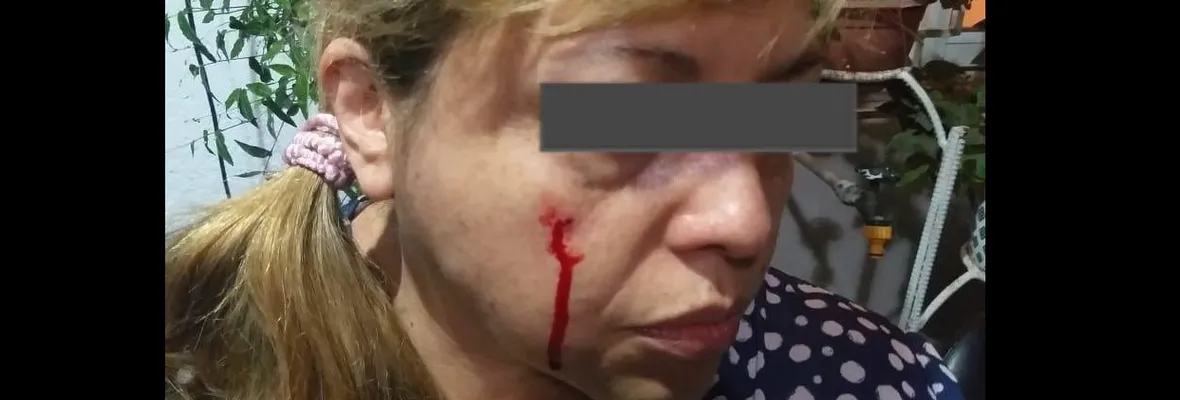 Secretaria del Colegio de Periodistas fue impactada por tres balines de Carabineros: “Cada vez más aumenta esta locura de disparar a todos lados”