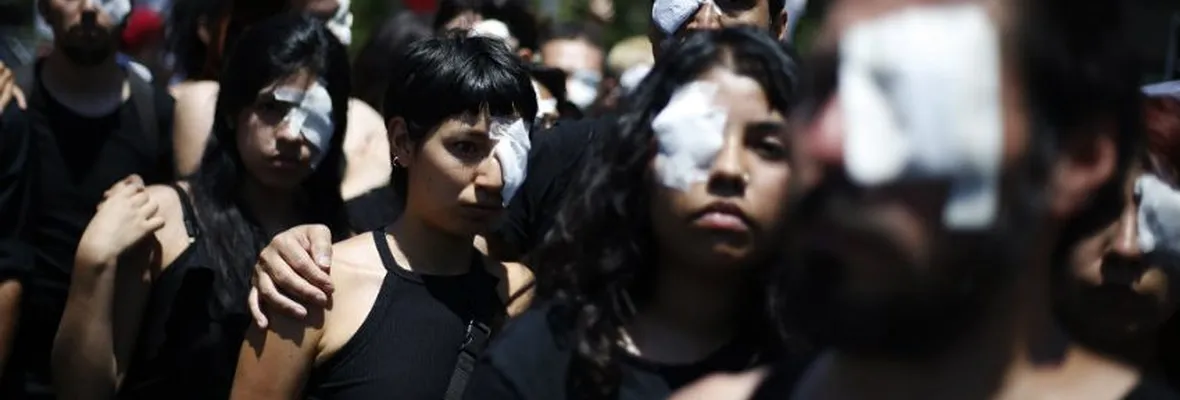 Periodista con trauma ocular tras formalización de carabinero en Concepción: "Ni con toda la plata del mundo podré hacerme un trasplante de mácula"