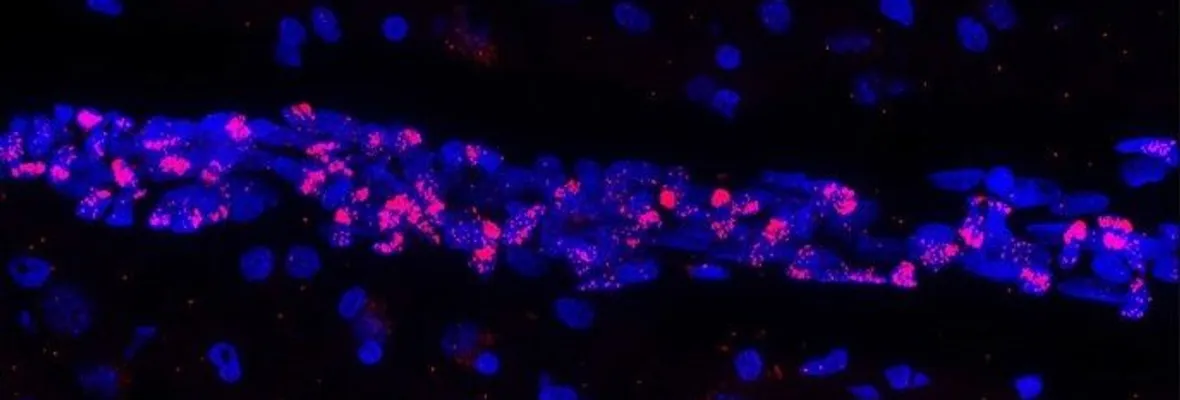 COVID-19: Estudio confirma daño en la irrigación sanguínea del cerebro y problemas neurológicos asociados