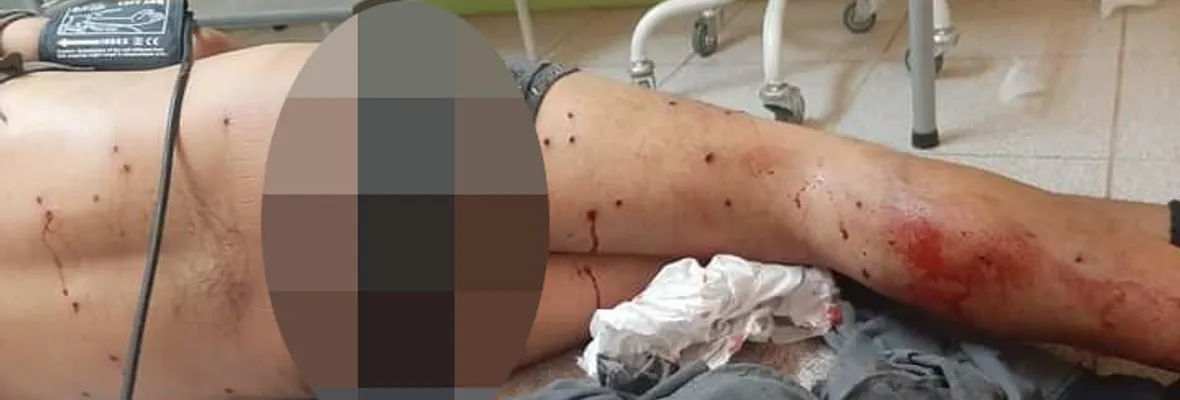 Irrupción de fuerzas policiales y militares en Temucuicui terminó con un adolescente con múltiples heridas de perdigones en su cuerpo