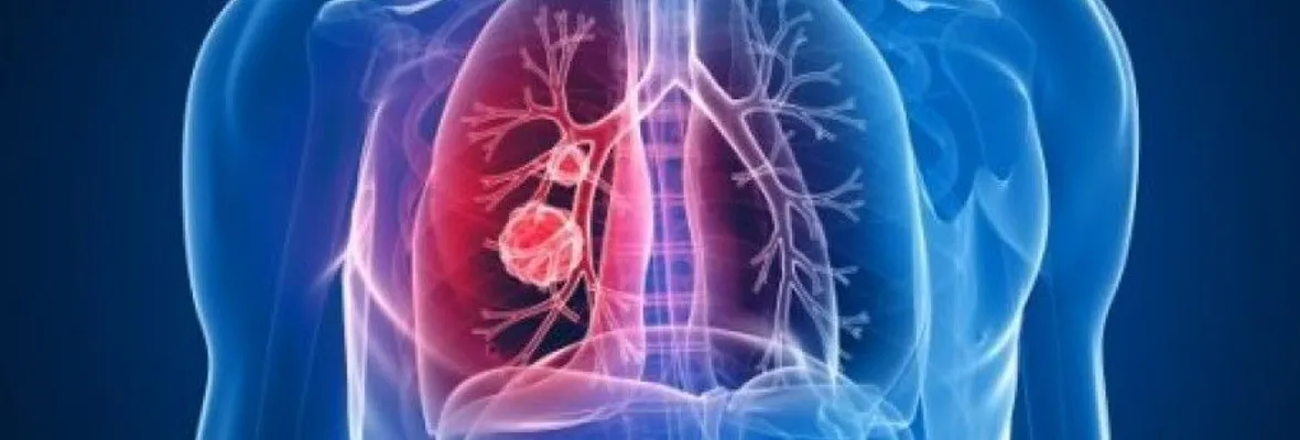 Muertes por enfermedades respiratorias han disminuido un 34% durante la pandemia