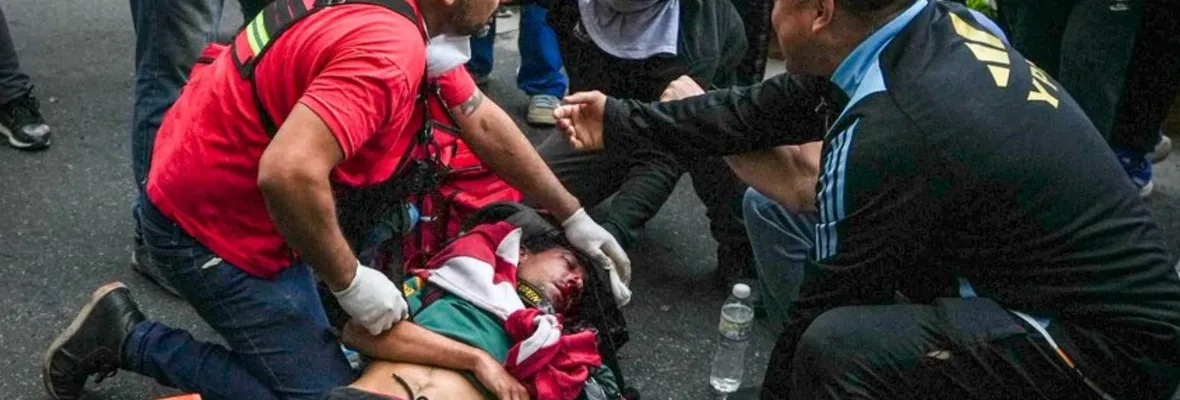 Brutalidad policial a la chilena: Milei reprime violentamente manifestación de jubilados