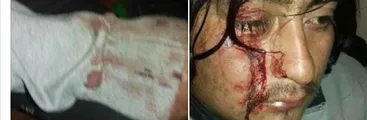 Carabineros atropella a comunero mapuche del Lov Mallekoche en Collipulli