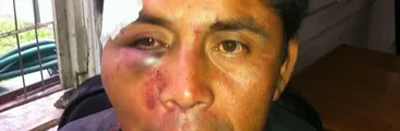 Condenan a Carabinero por salvaje golpiza contra Lonko Alberto Curamil en 2014