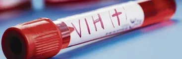 VIH: Mitos, datos, transmisión y responsabilidades públicas de esta emergencia en Chile