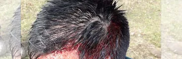 Operativo policial en Victoria deja a comunero mapuche herido de bala en la cabeza