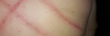 Golpiza de Gendarmería a presos en Coronel: INDH se querellará por torturas