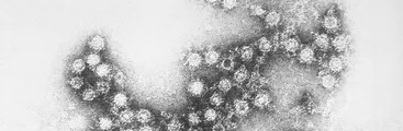 Los enterovirus que se adapten a ambientes cálidos podrían ser más difíciles de eliminar, indica estudio