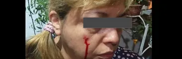 Secretaria del Colegio de Periodistas fue impactada por tres balines de Carabineros: “Cada vez más aumenta esta locura de disparar a todos lados”