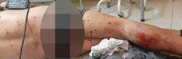 Irrupción de fuerzas policiales y militares en Temucuicui terminó con un adolescente con múltiples heridas de perdigones en su cuerpo