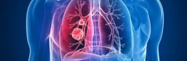 Muertes por enfermedades respiratorias han disminuido un 34% durante la pandemia