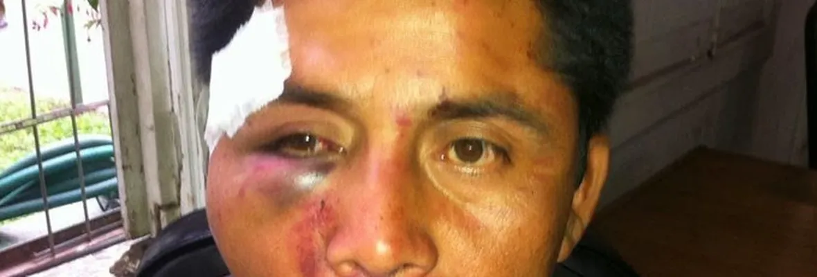 Condenan a Carabinero por salvaje golpiza contra Lonko Alberto Curamil en 2014