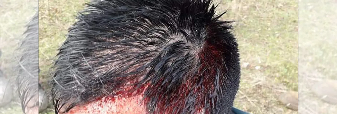 Mapuche Shot in Head During Police Operation in Chile